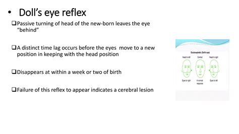 NEONATAL REFLEX.pptx