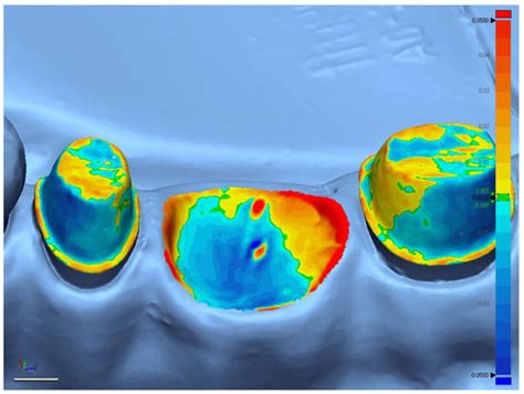 Is There a Significant Difference in Accuracy of Four Intraoral ...