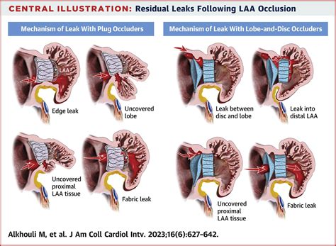 Peridevice Leak After Left Atrial Appendage Occlusion: Incidence, Mechanisms, Clinical Impact ...