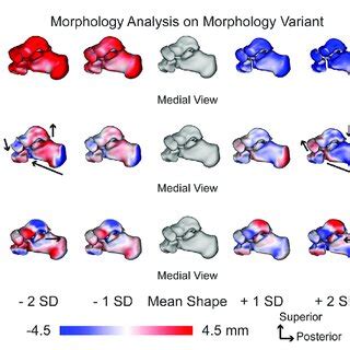 Image result for Type 1 Variation