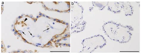 Glucose, Fructose, and Urate Transporters in the Choroid Plexus Epithelium