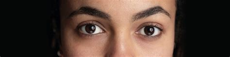 Natural Ingredients That Help Reduce Dark Circles