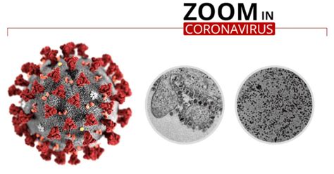 Coronavirus testing procedure explained: Cost, sampling process ...