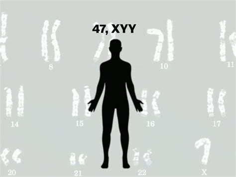 Xyy Syndrome Diagram