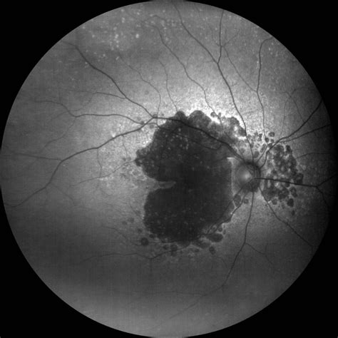 ZEISS CLARUS 500 Funduskamera