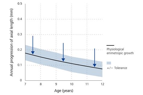ZEISS MyoCare lenses