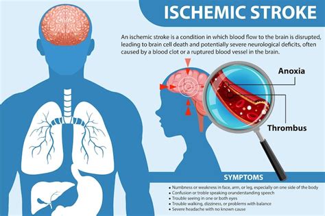 Page 8 | Images de Schema anatomie du cerveau surbrillance ...