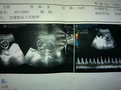十月怀胎，为什么孕七月要特别小心？ | 新闻资讯 | 广州爱博恩医疗集团有限公司