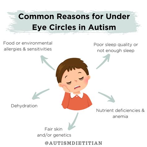 Why Does My Child Have Black Bags Under Eyes - Infoupdate.org