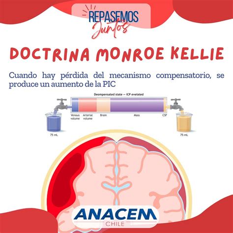 La Doctrina De Monro Kellie