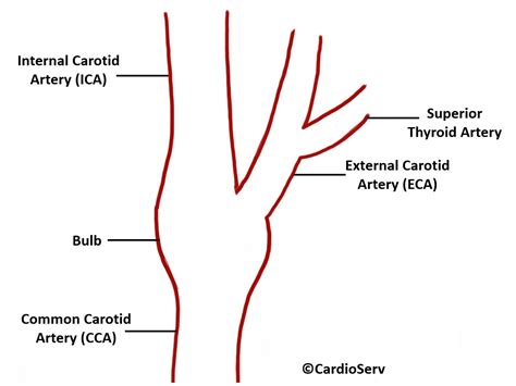 Carotid Artery Anatomy - Cardioserv