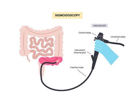 Premium Vector | Colonoscopy and sigmoidoscopy test examination and treatment of the large ...