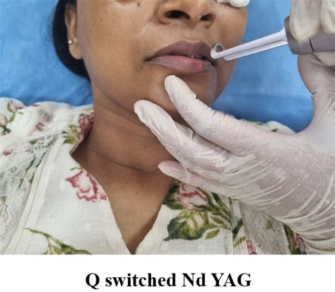 Department of Dermatology | GIMS