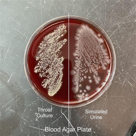 Blood Agar Alpha Beta Gamma