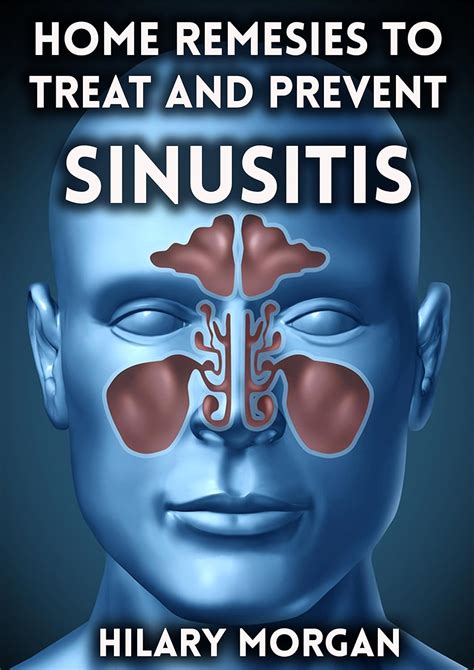Amazon.com: Home Remedies to Treat and Prevent Sinusitis (sinus infection, sinusitis symptoms ...
