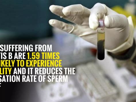 World Hepatitis Day: Hepatitis Can Be A Cause Of Infertility In Males