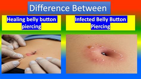 Image result for Getting Belly Button