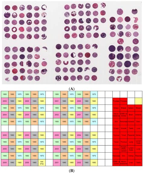 Can Archival Tissue Reveal Answers to Modern Research Questions ...