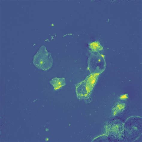 Cheek Cell Experiment Method 的图像结果