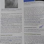 Buy Oral and Maxillofacial Pathology: First South Asia Edition Book ...