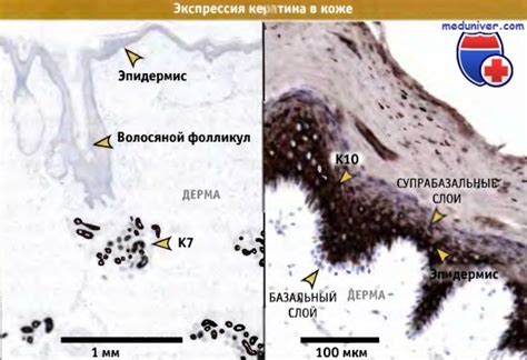 Кератины промежуточных филаментов