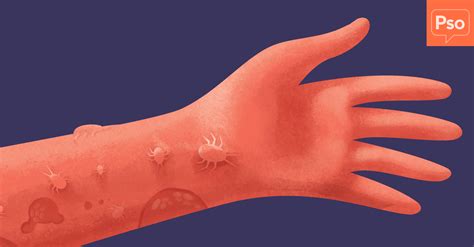 Skin Crawling Sensation