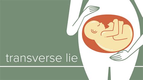 Best Sleeping Position If Baby Is Transverse at Cynthia Jasmin blog