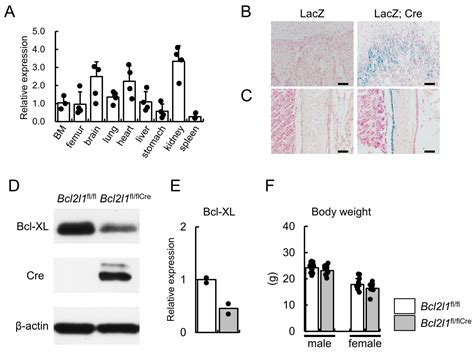 Bcl2l1 Deficiency in Osteoblasts Reduces the Trabecular Bone Due to ...