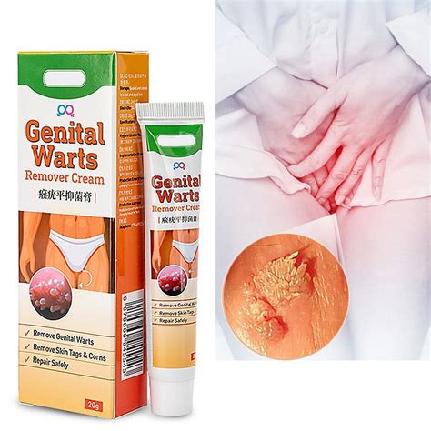 Cremas para herpes genital, pomada eliminadora de verrugas, Gel de acción rápida de máxima ...