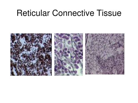 PPT - Connective Tissue PowerPoint Presentation, free download - ID:302079