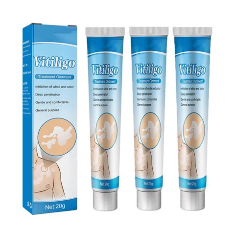 Buy Medix Vitiligo Cream, Vitiligo Repigmentation Cream, White Spot ...
