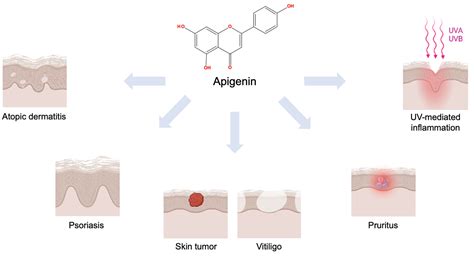 Apigenin: A Therapeutic Agent for Treatment of Skin Inflammatory ...