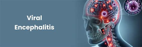 Understanding Viral Encephalitis: Symptoms and Treatment