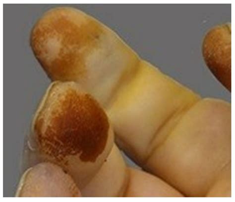 Evidence of Organ-Specific Metal Accumulation: ICP-MS Elemental ...