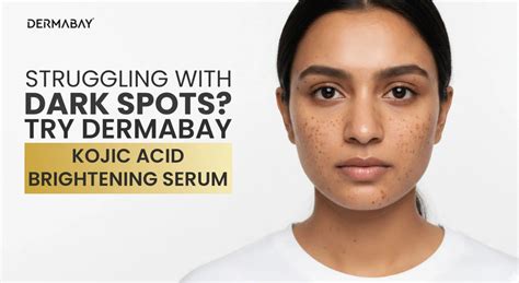Dermabay Kojic Acid Serum for Dark Spots & Pigmentation - Dermabay