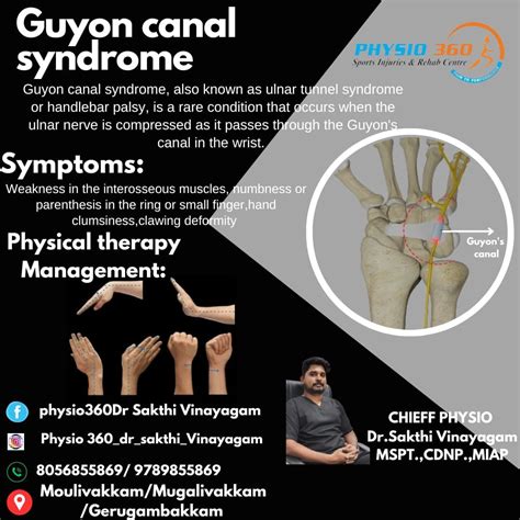 Guyon canal syndrome, also known as ulnar tunnel syndrome or handlebar palsy, is a condition ...