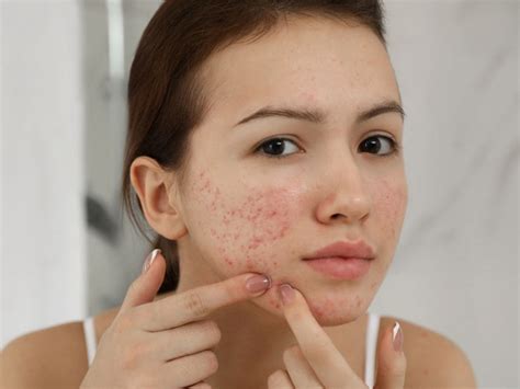 Skin Care: ये हैं मानसून में स्किन से जुड़े सबसे ज्यादा पूछे जाने वाले ...