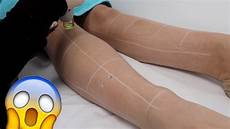 Leg Hair Removal by Getting Laser Hair Removal On My Legs Did It Hurt Leg Hair Removal