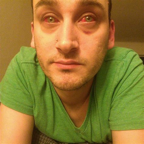 My Son's Eyes Keep Crossing at Linda Platt blog