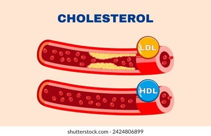 Image result for HDL Components Code