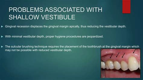 Mucogingival surgery in periodontics | PPTX