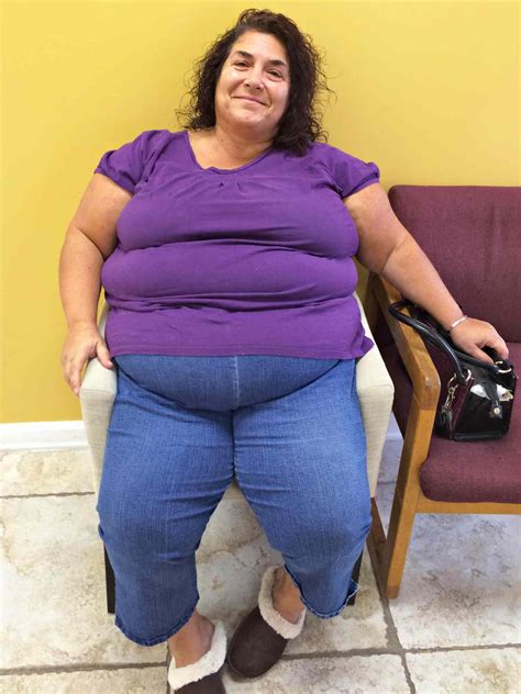 Close to Becoming Wheelchair-Bound, This Woman Lost 189 Lbs.