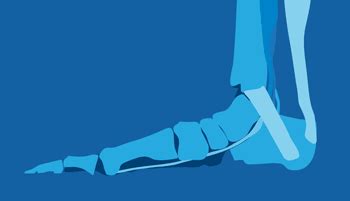 Are your flat feet causing your knee and lower back pain? | Zanskar ...