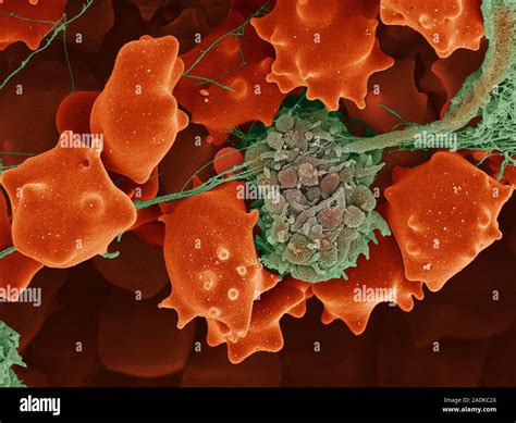 Blood clot. Coloured scanning electron micrograph (SEM) of a small ...