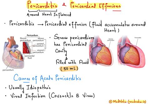 SOLUTION: Pericarditis pericardial effusions - Studypool
