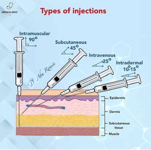 Angle of Injection 的图像结果