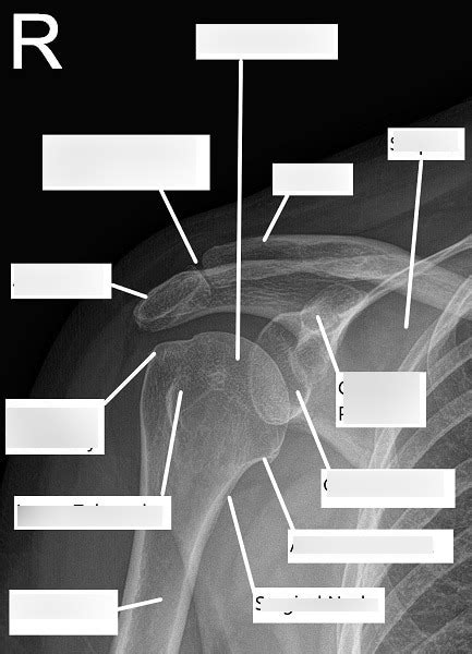 Image result for Shoulder Position at Address