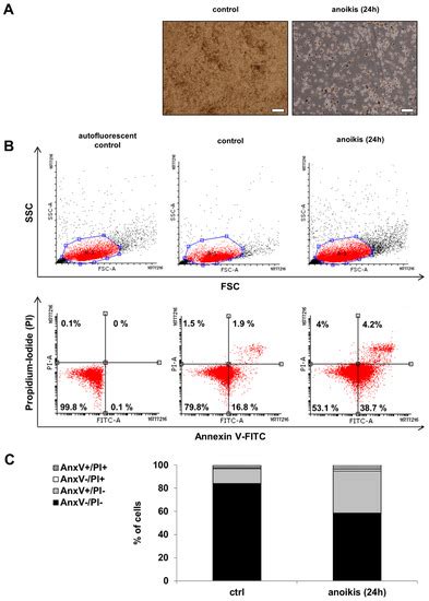 Human Embryonic Stem Cell-Derived Retinal Pigment Epithelium-Role in ...