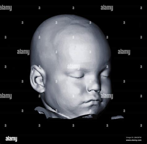 Ct scan child hi-res stock photography and images - Alamy