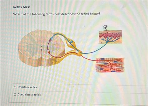 Image result for Contralateral Reflex Example